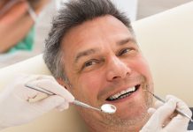 The Benefits of Dental Bonding