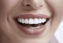 The Benefits of Teeth Implants: Restoring Your Smile and Confidence