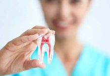 From Teeth Whitening to Root Canals: Understanding the Different Services Offered by Dentists